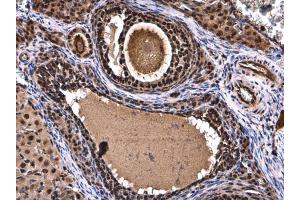 Immunohistochemistry (IHC) image for anti-X-Box Binding Protein 1 (XBP1) antibody (ABIN2855334)