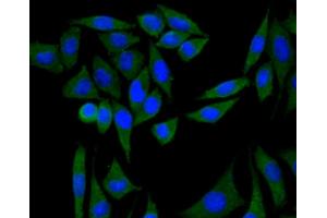 MCF7 cells were fixed with paraformaldehyde, permeabilized with 0. (PIK3R1 Antikörper)