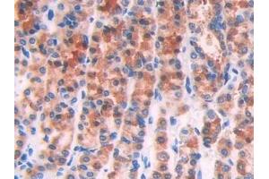 Immunohistochemistry (IHC) image for anti-Interleukin 1 Receptor, Type I (IL1R1) (AA 119-217) antibody (ABIN7430741)