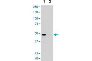 Western blot analysis of pre-incubated with (2) and without (1) blocking peptide in 293 cell lysate with MAGEA11 polyclonal antibody . (MAGEA11 Antikörper  (N-Term))