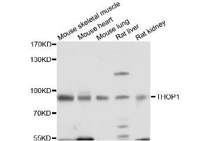 Western blot analysis of extracts of various cell lines, using THOP1 antibody (ABIN5996210) at 1/1000 dilution.