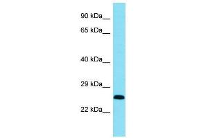 Host:  Rabbit  Target Name:  Bcl11a  Sample Type:  Mouse Heart lysates  Antibody Dilution:  1. (BCL11A Antikörper  (C-Term))
