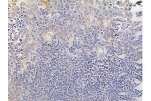 ABIN6256090 and ABIN6267276 at 1/100 staining human normal tonsil tissue by IHC-P. (Estrogen Receptor alpha Antikörper  (pSer104))