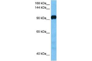 Host:  Mouse  Target Name:  ATP2A3  Sample Tissue:  Mouse Liver  Antibody Dilution:  1ug/ml (ATP2A2 Antikörper  (C-Term))