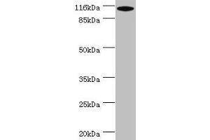 Western blot All lanes: MYO19 antibody at 2 μg/mL + A549 whole cell lysate Secondary Goat polyclonal to rabbit IgG at 1/10000 dilution Predicted band size: 110, 36, 72, 87 kDa Observed band size: 110 kDa (Myosin XIX Antikörper  (AA 2-770))
