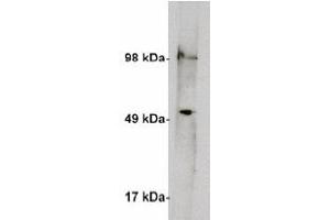 Image no. 2 for anti-serine Palmitoyltransferase, Long Chain Base Subunit 1 (SPTLC1) antibody (ABIN4620353) (SPTLC1 Antikörper)