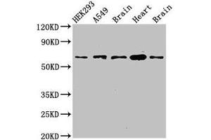 Western Blot Positive WB detected in: HEK293 whole cell lysate, A549 whole cell lysate, Mouse brain tissue, Mouse heart tissue, Rat brain tissue All lanes: PXK antibody at 2. (PXK Antikörper  (AA 1-200))