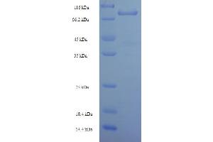SDS-PAGE (SDS) image for Leucine Rich Repeat Neuronal 1 (LRRN1) (AA 26-631) protein (His-SUMO Tag) (ABIN5711441)