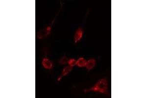 ABIN6274937 staining LOVO cells by IF/ICC. (CAPN10 Antikörper  (N-Term))