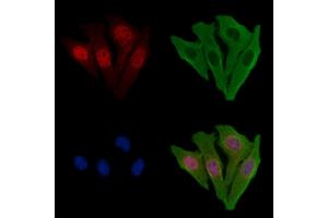 ABIN6256983 and ABIN6274937 staining Hela cells by IF/ICC. (CAPN10 Antikörper  (N-Term))