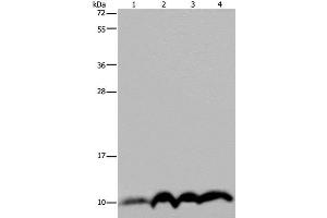 Western Blot analysis of SKOV3 cell and Human fetal liver tissue, Human fetal brain tissue and Hela cell using NDUFA4 Polyclonal Antibody at dilution of 1:300 (NDUFA4 Antikörper)
