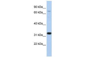 CACNB2 antibody used at 1 ug/ml to detect target protein. (CACNB2 Antikörper  (N-Term))