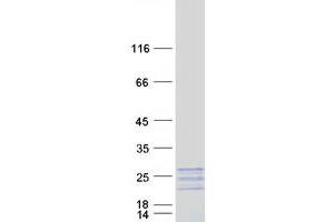 Western Blotting (WB) image for Myosin Light Chain 7, Regulatory (MYL7) protein (Myc-DYKDDDDK Tag) (ABIN2726680)