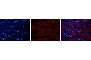 Rabbit Anti-AKT2 Antibody   Formalin Fixed Paraffin Embedded Tissue: Human heart Tissue Observed Staining: Cytoplasmic, plasma membrane in intercalated disc Primary Antibody Concentration: 1:100 Other Working Concentrations: 1:600 Secondary Antibody: Donkey anti-Rabbit-Cy3 Secondary Antibody Concentration: 1:200 Magnification: 20X Exposure Time: 0.