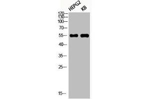 Western Blot analysis of HEPG2 KB using Phospho-Akt1 (S246) Polyclonal Antibody (AKT1 Antikörper  (pSer246))
