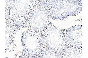 ABIN7094735 and ABIN7098786 at 1/100 staining Rat testis tissue by IHC-P. (POLQ Antikörper  (Internal Region))
