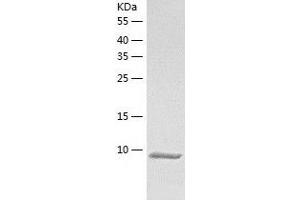 Western Blotting (WB) image for Dynein, Light Chain, LC8-Type 1 (DYNLL1) (AA 1-89) protein (His tag) (ABIN7122721)