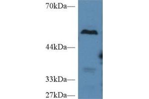Western Blotting (WB) image for anti-Carboxypeptidase B2 (Plasma) (CPB2) (AA 113-422) antibody (ABIN7438442)