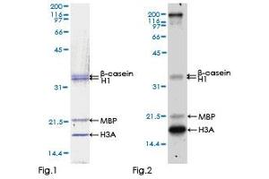 Kinase Activity Assay (KAA) image for Eukaryotic Elongation Factor-2 Kinase (EEF2K) (AA 1-725) protein (GST tag) (ABIN1352365)