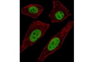 Fluorescent image of A549 cell stained with TFD Antibody (C-term) (ABIN1537108 and ABIN2849445).