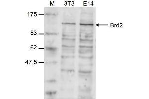 Western Blot of anti-Brd2 antibody Western Blot results of Rabbit anti-Brd2 antibody. (BRD2 Antikörper  (Internal Region))