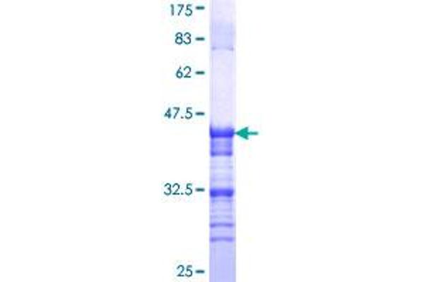 TRPV1 Protein (AA 21-124) (GST tag)
