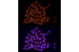 Immunofluorescence analysis of HeLa cells using TCE Rabbit mAb (ABIN7270877) at dilution of 1:25 (40x lens). (TCEA1 Antikörper)