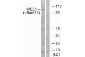 Western blot analysis of extracts from 293 cells treated with etoposide 25uM 60', using WEE1 (Phospho-Ser642) Antibody. (WEE1 Antikörper  (pSer642))