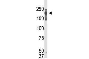 Western blot analysis of PRDM2 / RIZ1 antibody and transfected cell lysate (PRDM2 Antikörper  (AA 1-347))