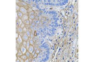 Immunohistochemistry of paraffin-embedded human esophagus using COL1A1 antibody. (COL1A1 Antikörper)