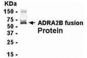 Western Blotting (WB) image for anti-Adrenergic, alpha-2B-, Receptor (ADRA2B) (AA 200-299) antibody (ABIN2467937)