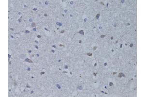 Immunohistochemistry of paraffin-embedded rat brain using BDNF antibody. (BDNF Antikörper)