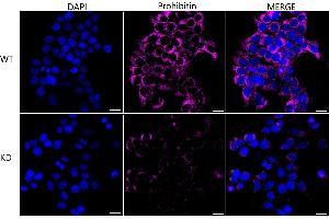 anti-Prohibitin (PHB) antibody