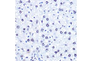 Immunohistochemistry (IHC) image for anti-Chromodomain Helicase DNA Binding Protein 4 (CHD4) (AA 1520-1690) antibody (ABIN6138512)