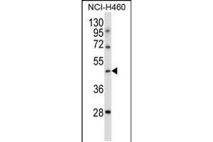 Western blot analysis in NCI-H460 cell line lysates (35ug/lane). (TLE6 Antikörper  (N-Term))