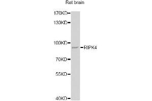 Western blot analysis of extracts of rat brain, using RIPK4 antibody. (RIPK4 Antikörper)