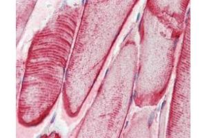 Immunohistochemical analysis of paraffin-embedded human skeletal muscle tissues using CRYAB mouse mAb.