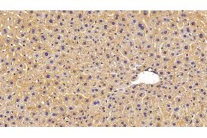 Detection of MASP1 in Mouse Liver Tissue using Polyclonal Antibody to Mannose Associated Serine Protease 1 (MASP1) (MASP1 Antikörper  (AA 25-453))