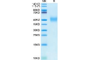 SDS-PAGE (SDS) image for Poliovirus Receptor (PVR) (AA 28-343) protein (His tag) (ABIN7274060)