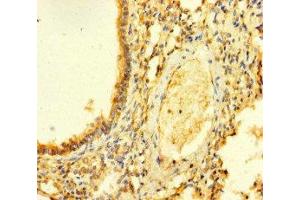 Immunohistochemistry of paraffin-embedded human lung tissue using ABIN7153265 at dilution of 1:100 (FGD5 Antikörper  (AA 269-539))