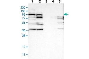 Western blot analysis of Lane 1: RT-4, Lane 2: U-251 MG, Lane 3: Human Plasma, Lane 4: Liver, Lane 5: Tonsil with RRP1B polyclonal antibody  at 1:250-1:500 dilution. (RRP1B Antikörper)
