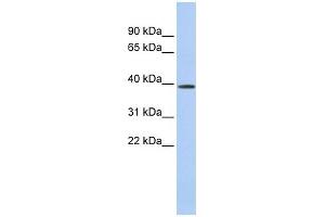 CLN6 antibody used at 1 ug/ml to detect target protein. (CLN6 Antikörper  (Middle Region))