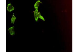 Immunofluorescence of monoclonal antibody to SMN2 on HeLa cell. (SMN2 Antikörper  (AA 1-282))
