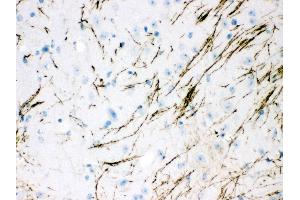 Anti- TH Picoband antibody,IHC(P) IHC(P): Mouse Brain Tissue (TH Antikörper  (Middle Region))