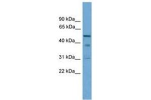 Image no. 1 for anti-Tubulointerstitial Nephritis Antigen (TINAG) (AA 251-300) antibody (ABIN6745079) (TINAG Antikörper  (AA 251-300))