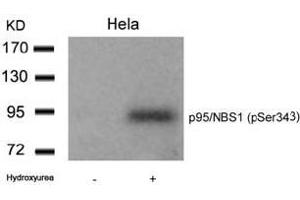 Image no. 1 for anti-Nibrin (NBN) (pSer343) antibody (ABIN196715) (Nibrin Antikörper  (pSer343))