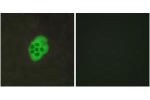 Immunofluorescence analysis of MCF7 cells, using HTR4 Antibody. (Serotonin Receptor 4 Antikörper  (AA 141-190))