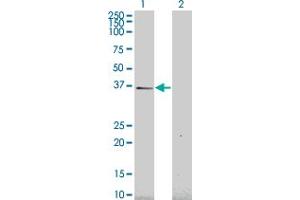 Western Blot analysis of HEY1 expression in transfected 293T cell line by HEY1 monoclonal antibody (M02), clone 2F10. (HEY1 Antikörper  (AA 121-220))
