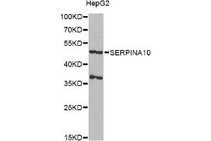 Western blot analysis of extracts of HepG2 cells, using SERPINA10 antibody (ABIN6292722) at 1:1000 dilution. (SERPINA10 Antikörper)