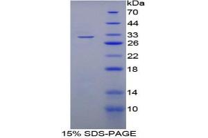 SDS-PAGE analysis of Rat A2BP1 Protein. (A2BP1 Protein)